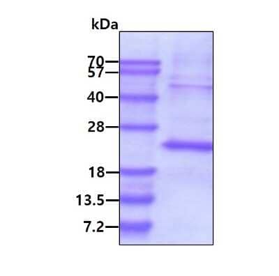 SDS-Page: Recombinant Human TSSC3 His Protein [NBP1-44473] - 3ug by SDS-PAGE under reducing condition and visualized by coomassie blue stain.